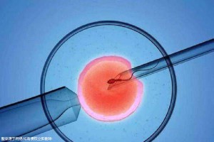 青碧生殖医学中心