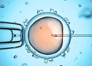 反复流产